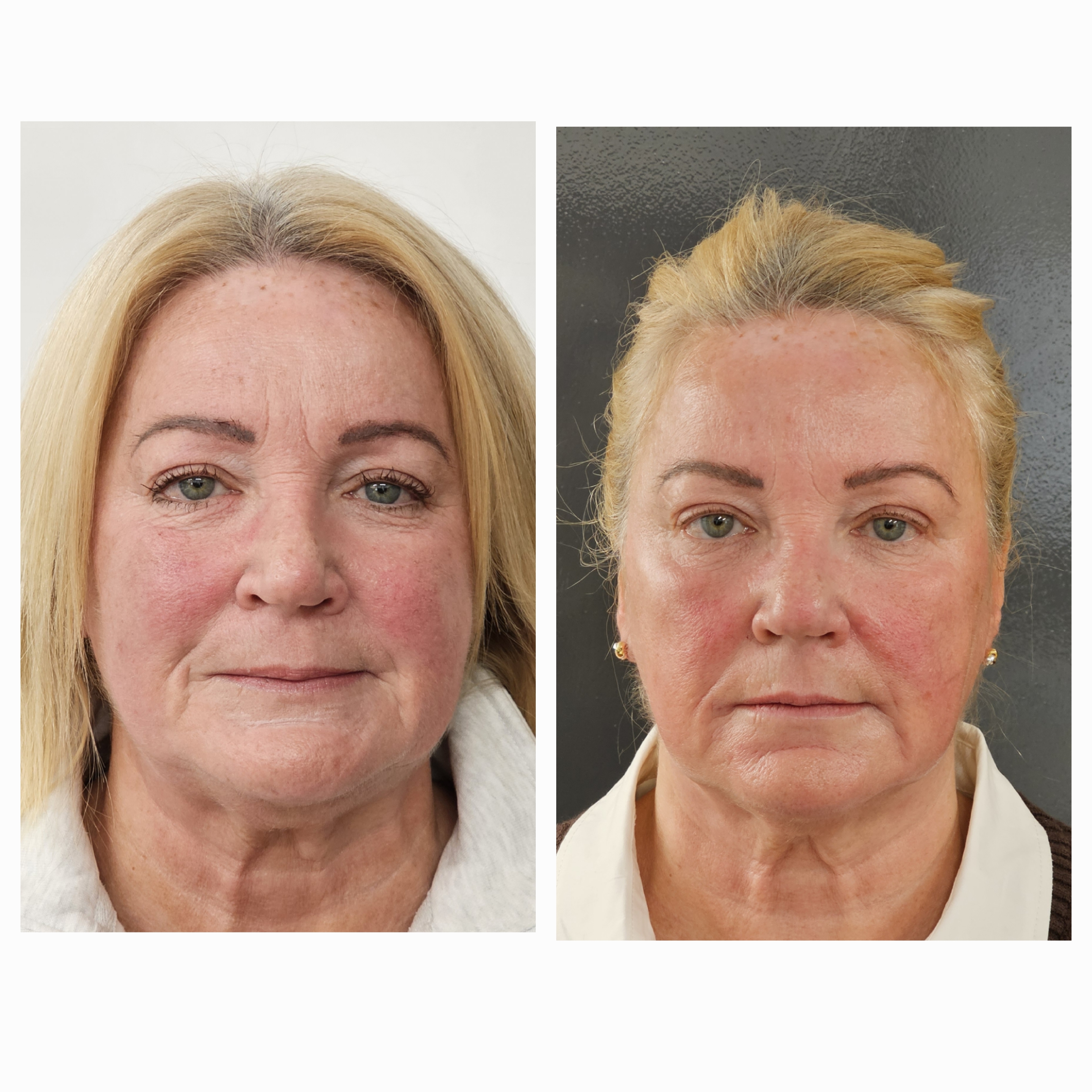 Patient result