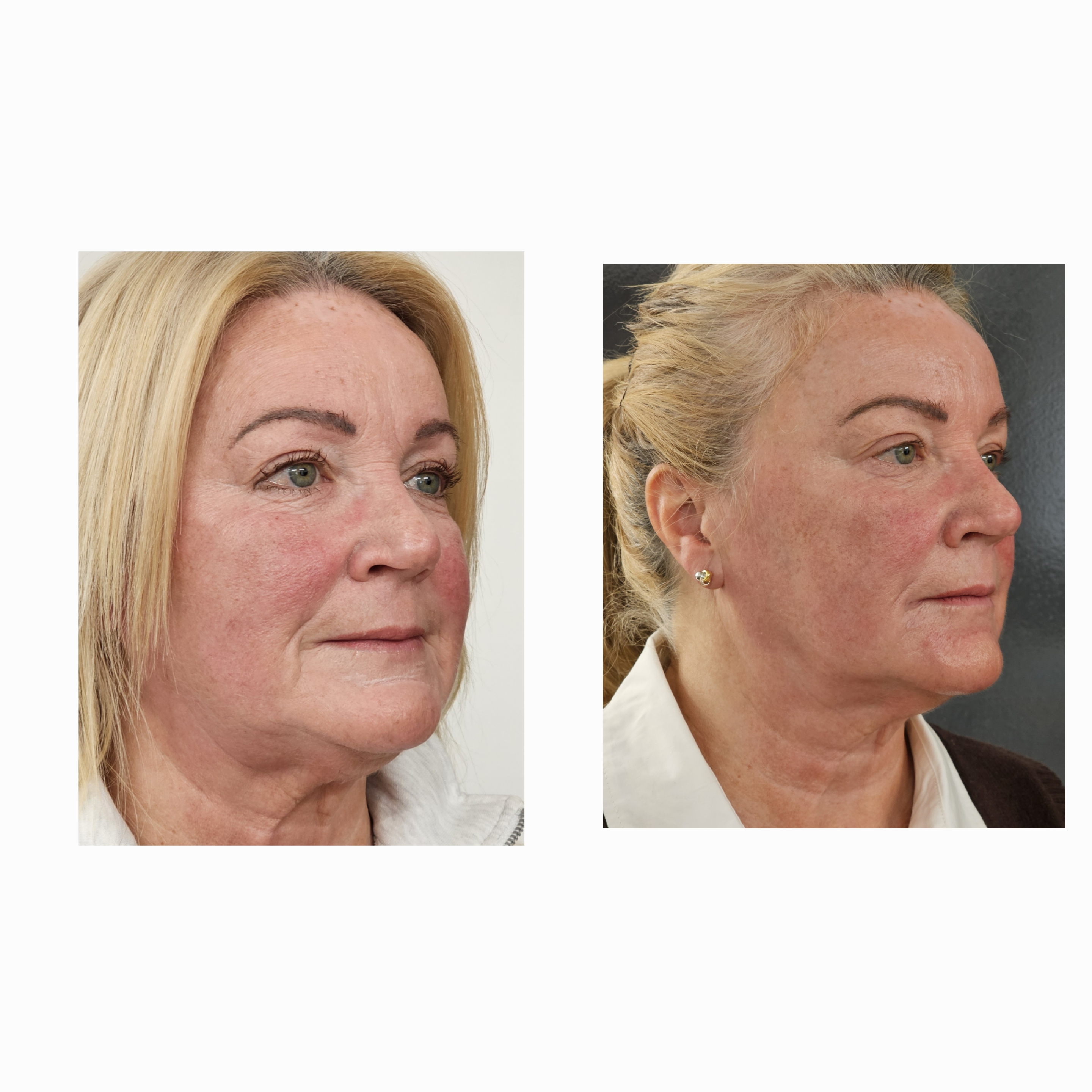 Patient result