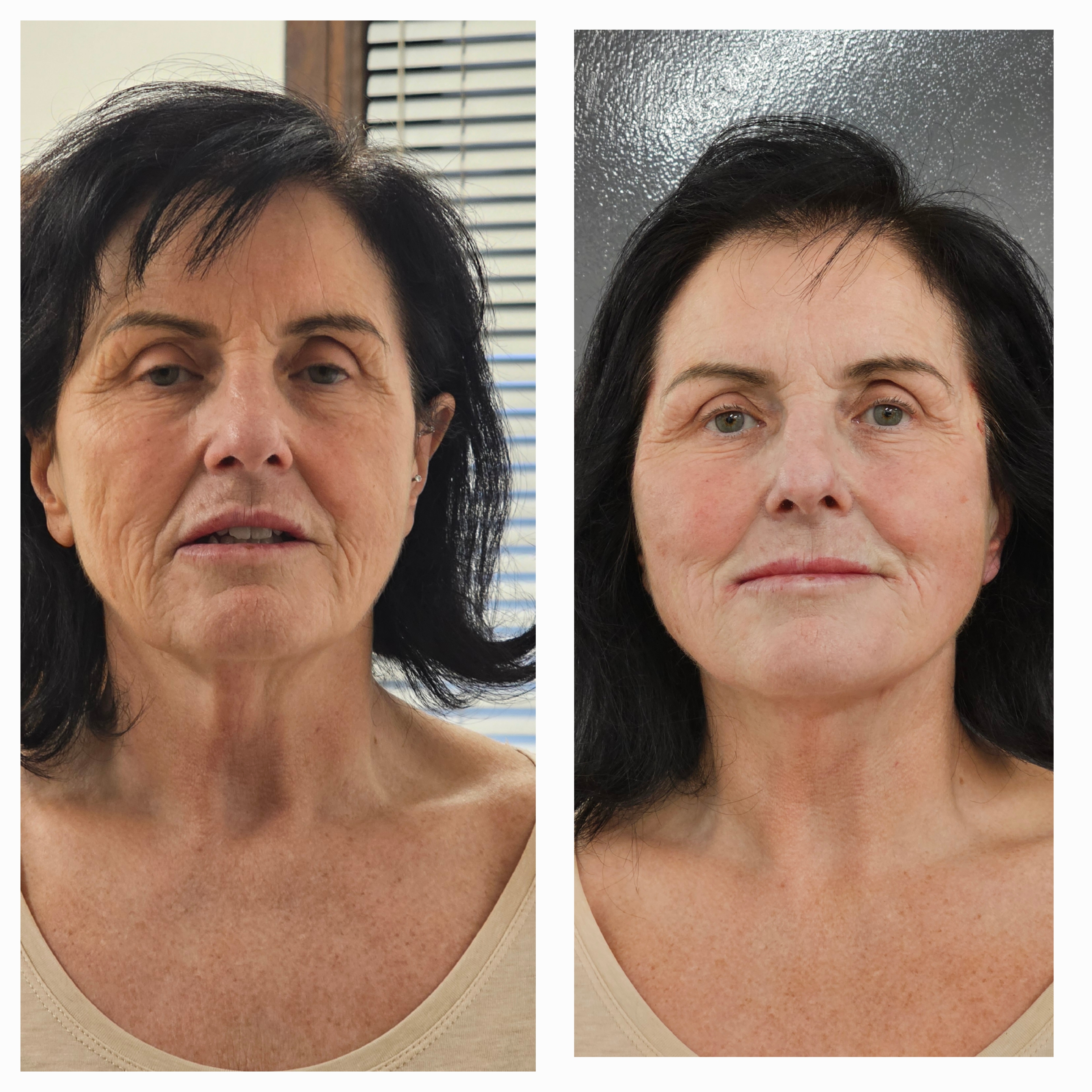 Patient result