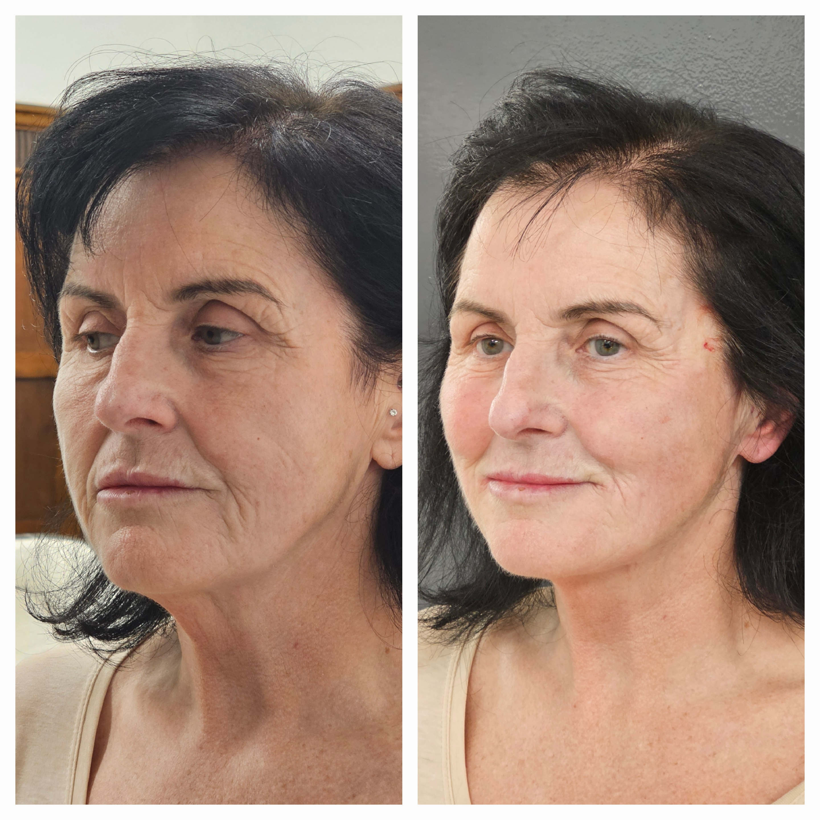 Patient result