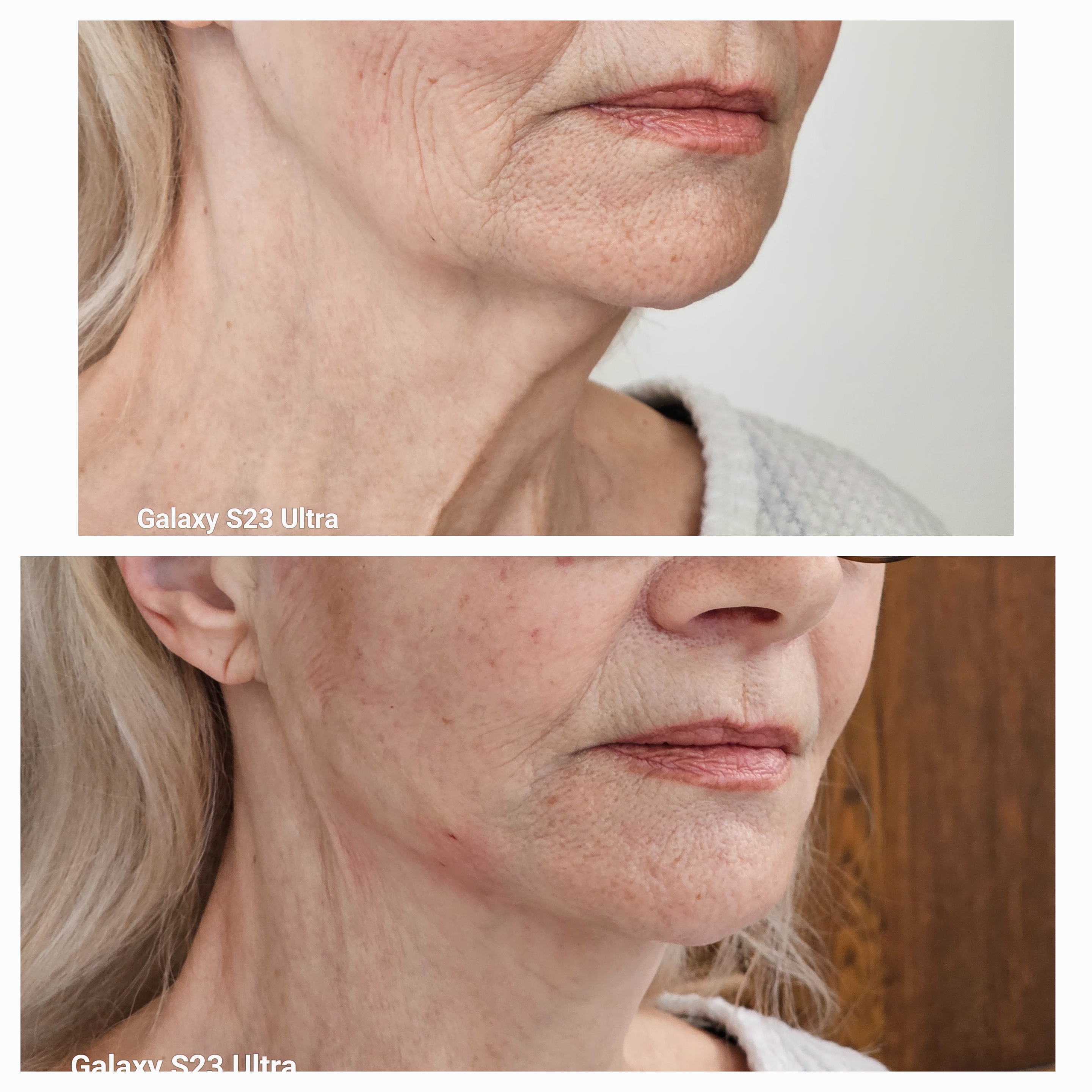 Patient result