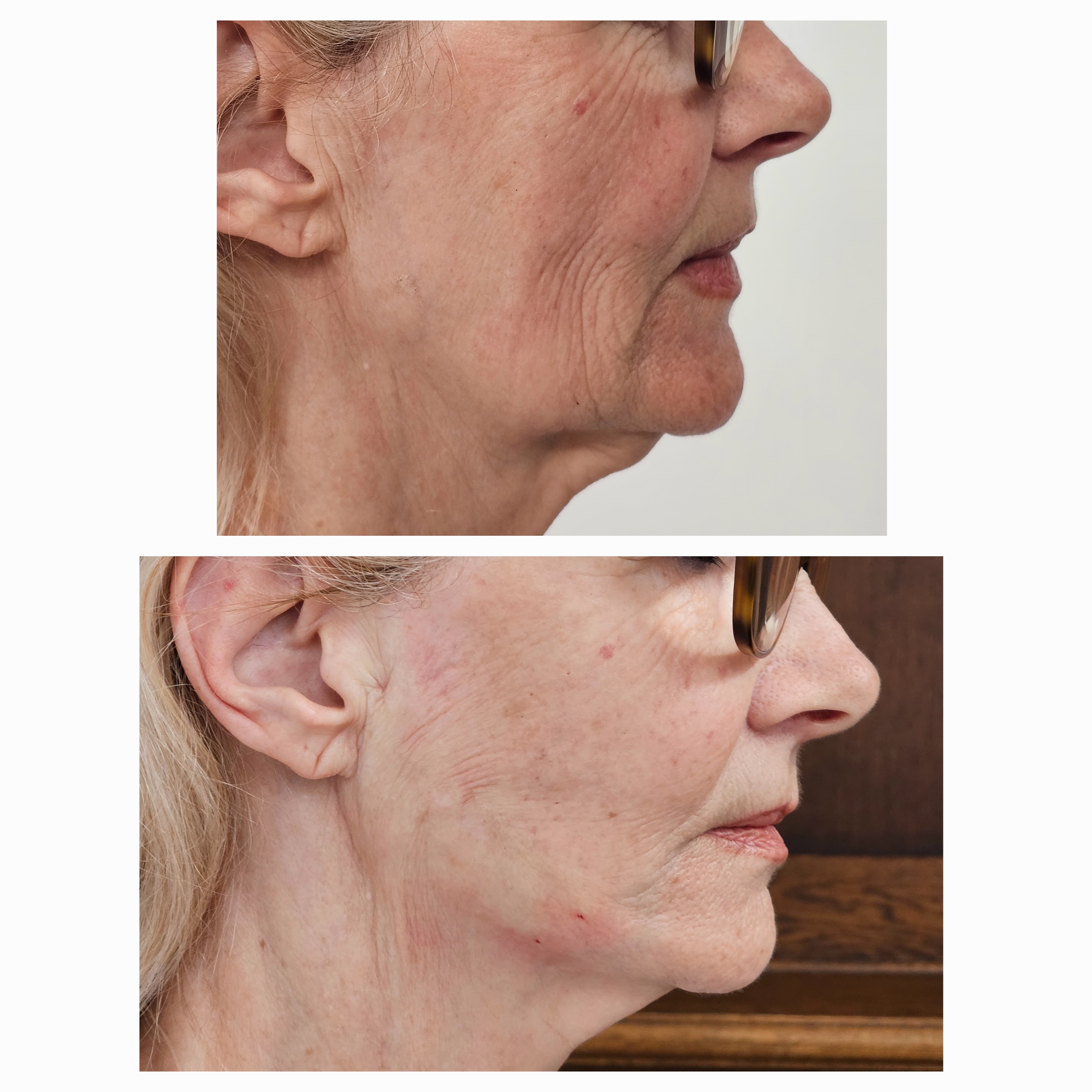 Patient result