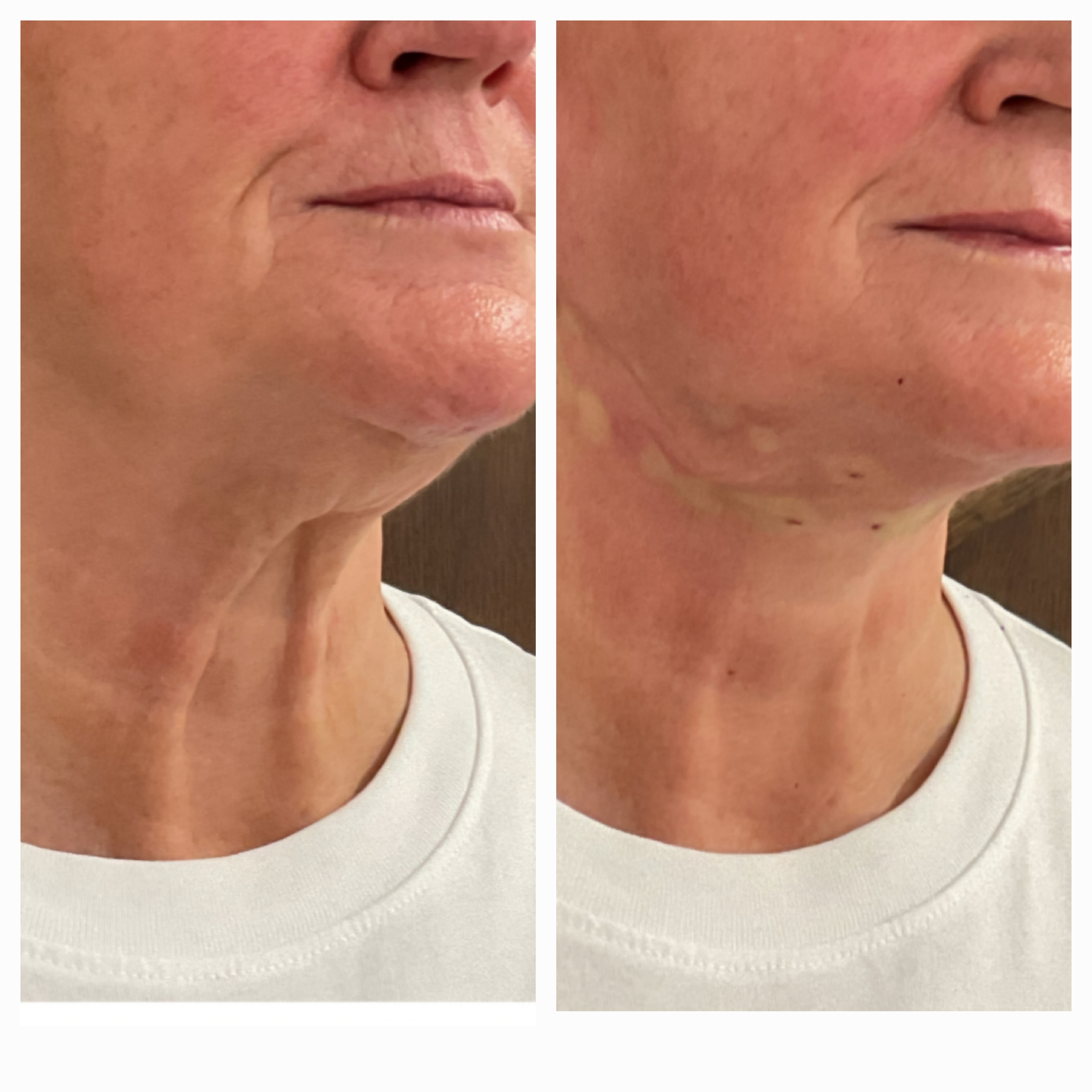 Patient result
