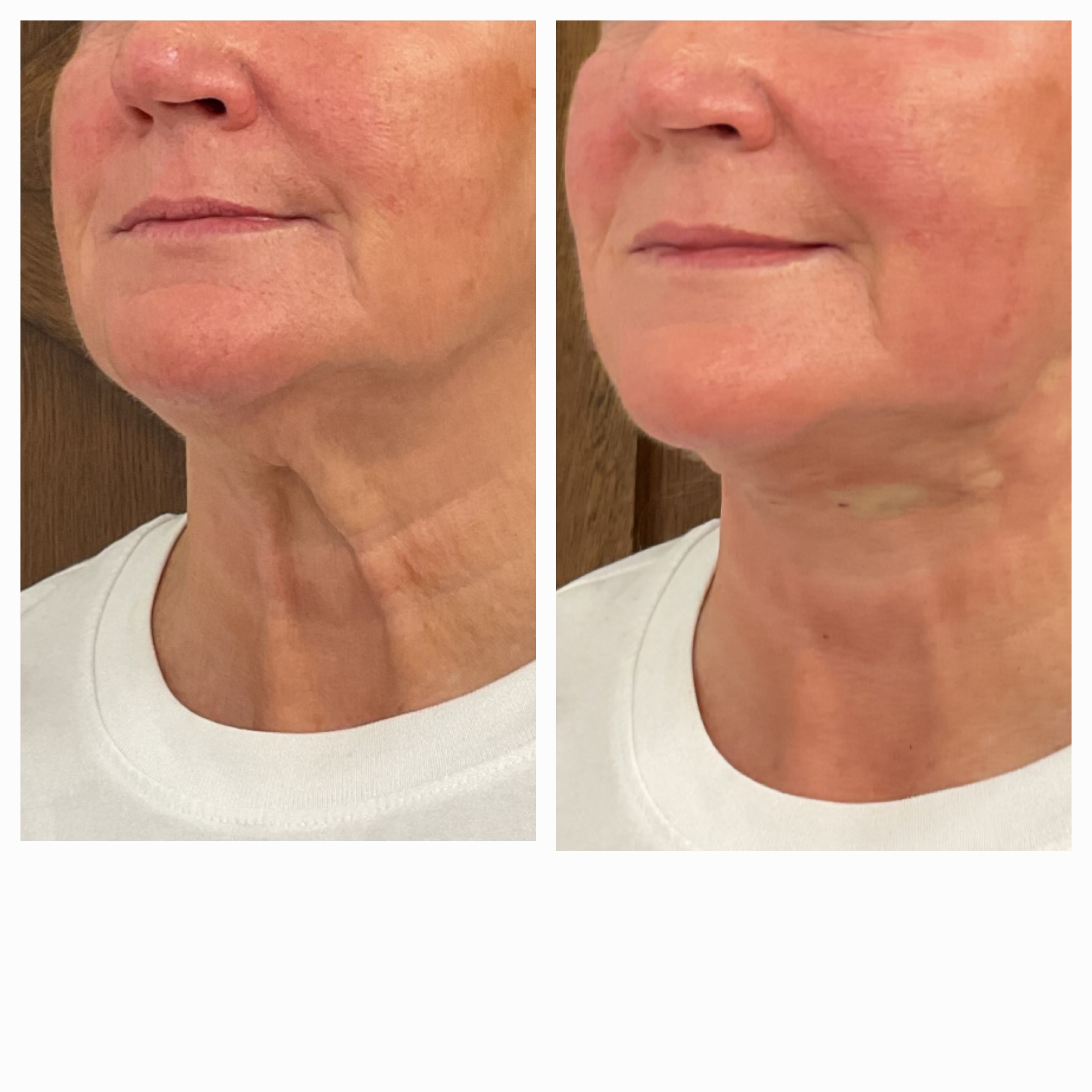 Patient result