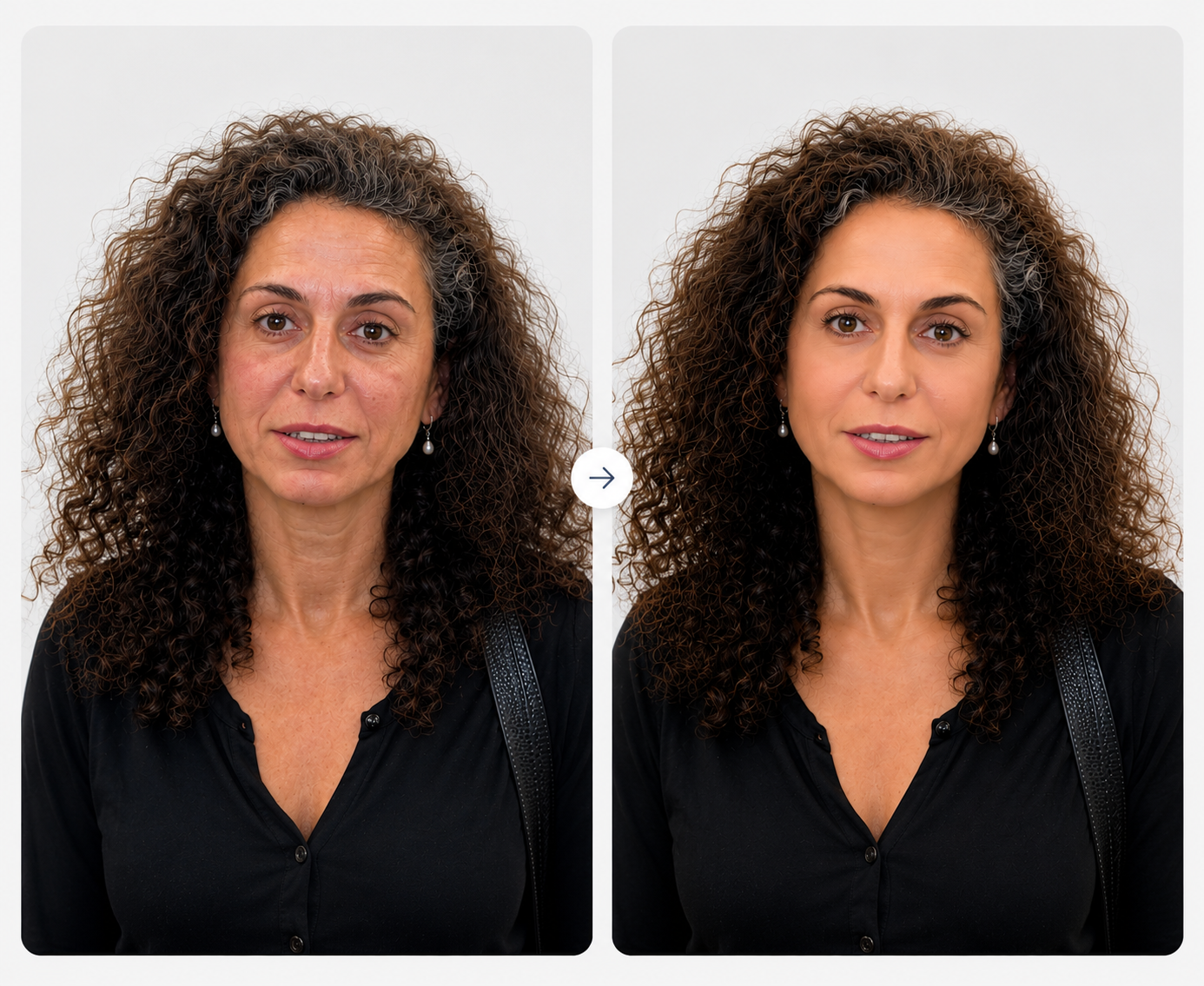 Thread lift result
