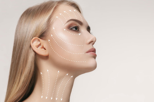Areas Treated With Threadlift